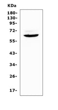Anti-Heparanase 1/Hpse Antibody Picoband®