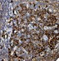 Anti-CD74 Antibody