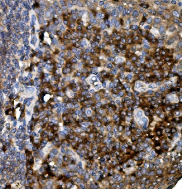Anti-CD74 Antibody