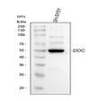 Anti-DOPA decarboxylase/DDC Antibody Picoband®