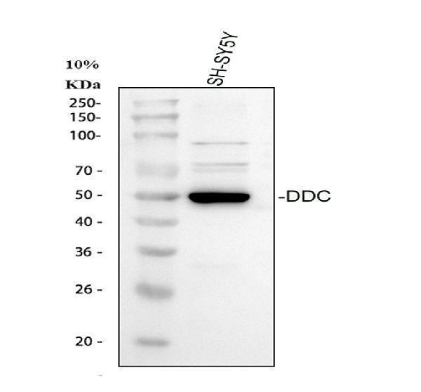 Anti-DOPA decarboxylase/DDC Antibody Picoband®