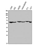 Anti-ME2 Antibody Picoband®