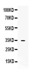 Anti-NAT1 Antibody Picoband®