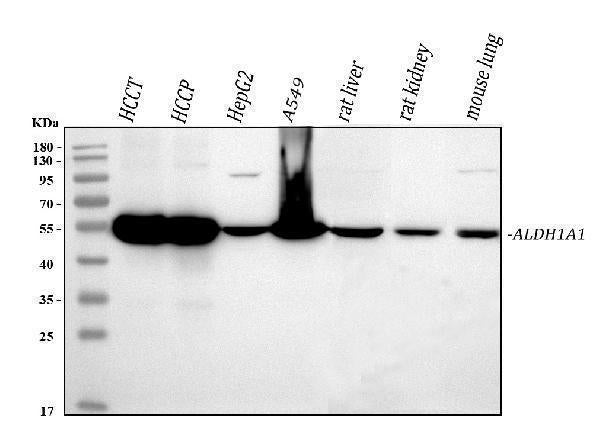 Anti-Retinal dehydrogenase 1 ALDH1A1 Antibody Picoband®