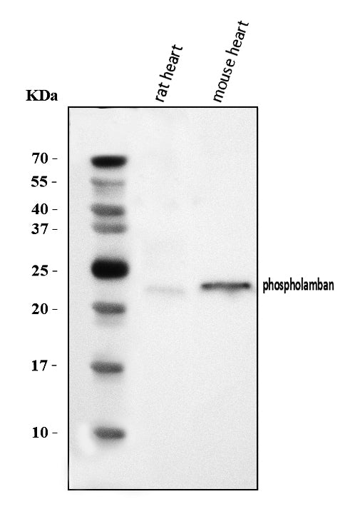Anti-Phospholamban/PLN Antibody Picoband®