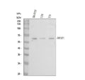 Anti-Bestrophin/BEST1 Antibody Picoband®