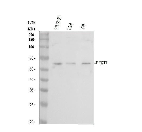 Anti-Bestrophin/BEST1 Antibody Picoband®