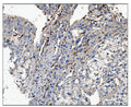 Anti-CD16/FCGR3A Antibody