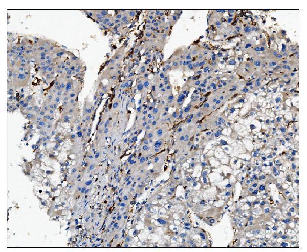 Anti-CD16/FCGR3A Antibody