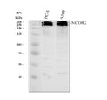 Anti-NCOR2 Antibody Picoband®