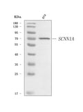 Anti-epithelial Sodium Channel alpha/SCNN1A Antibody Picoband®