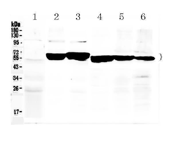 Anti-Cytokeratin 8/KRT8 Antibody Picoband®