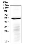 Anti-IL6R Antibody Picoband®