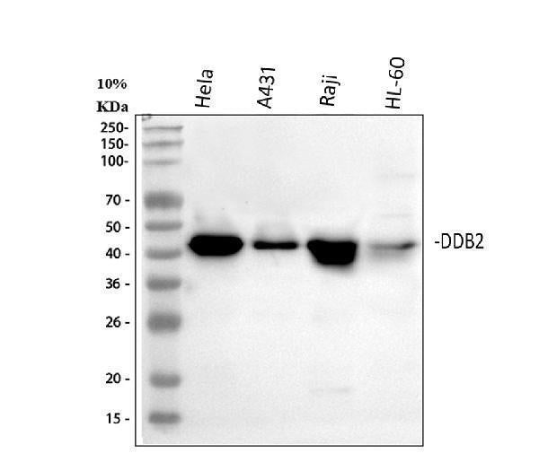 Anti-DDB2 Antibody Picoband®