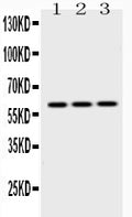 Anti-Cytokeratin 14/KRT14 Antibody Picoband®
