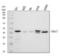 Anti-GALT Antibody Picoband®