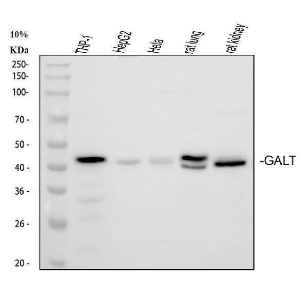 Anti-GALT Antibody Picoband®