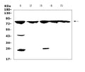 Anti-GRK2/GRK2 Antibody Picoband®