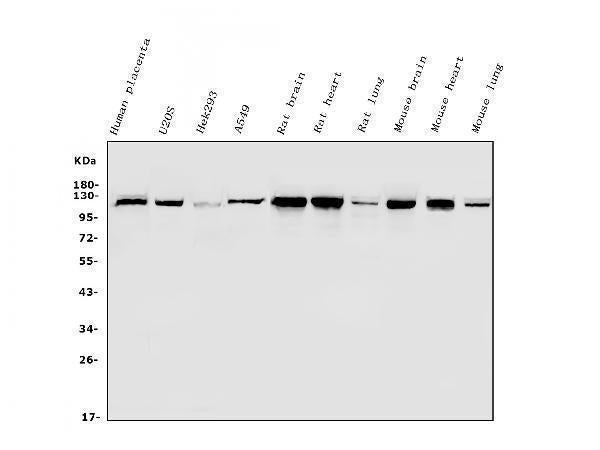 Anti-Hexokinase 1/HK1 Antibody Picoband®