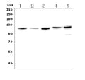 Anti-Eph receptor B2/EPHB2 Antibody Picoband®