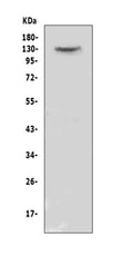 Anti-CACNA2D2 Antibody Picoband®