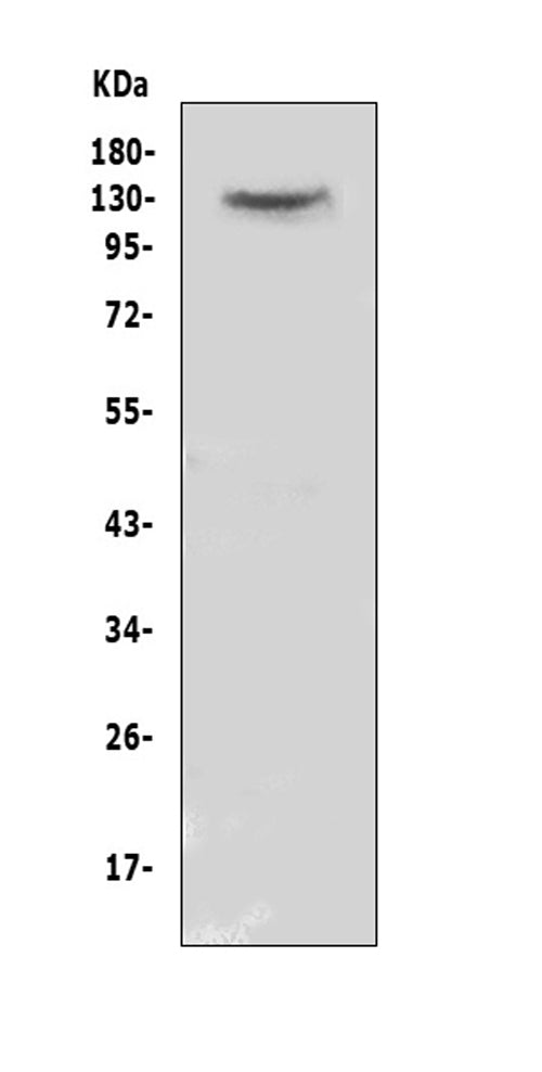 Anti-CACNA2D2 Antibody Picoband®
