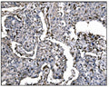 Anti-Fos B/FOSB Antibody