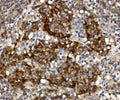 Anti-Claudin 1/CLDN1 Antibody