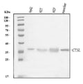 Anti-Cathepsin L/MEP/CTSL Antibody Picoband®