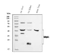 Anti-Cathepsin L/MEP/Ctsl Antibody Picoband®