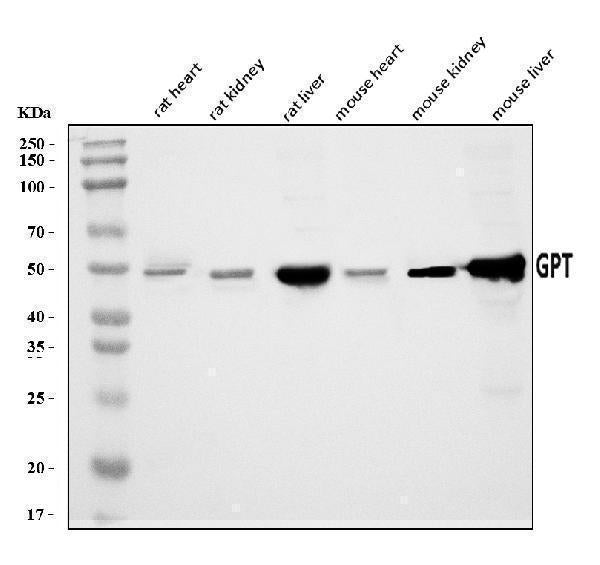 Anti-Alanine Transaminase/Gpt Antibody Picoband®