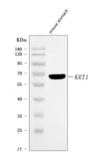 Anti-Cytokeratin 1/Krt1 Antibody Picoband®