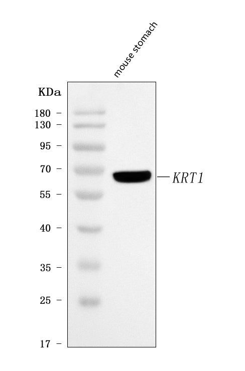 Anti-Cytokeratin 1/Krt1 Antibody Picoband®