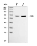 Anti-Cytokeratin 1/KRT1 Antibody Picoband®