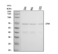 Anti-Carboxypeptidase M/CPM Antibody Picoband®