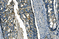 Anti-FGF4 Antibody