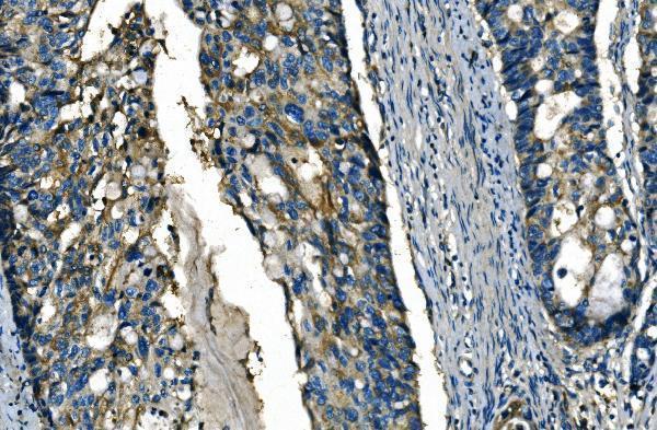 Anti-FGF4 Antibody