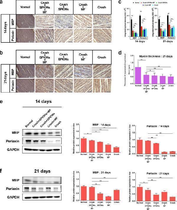 Anti-PRX Antibody Picoband®