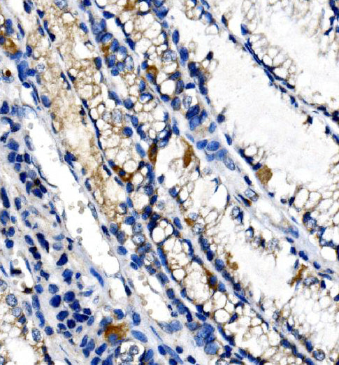 Anti-Ghrelin/GHRL Antibody