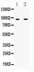 Anti-IFNGR1 Antibody Picoband®