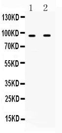 Anti-IFNGR1 Antibody Picoband®