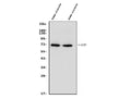 Anti-Placental alkaline phosphatase (PLAP)/ALPP Antibody Picoband®