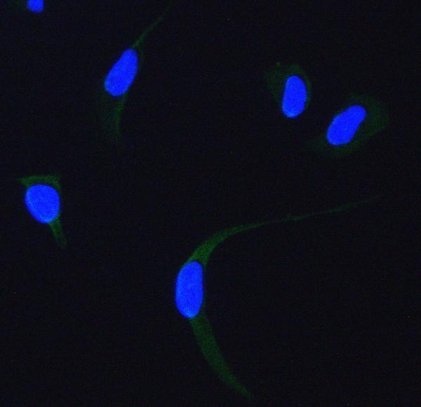 Anti-SDHA Antibody Picoband®