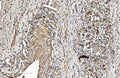 Anti-COL4A3 Antibody