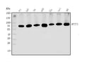 Anti-METTL3 Antibody Picoband®