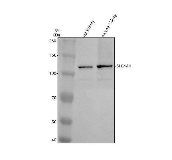 Anti-SLC4A4 Antibody Picoband®