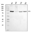 Anti-RRM1 Antibody Picoband®