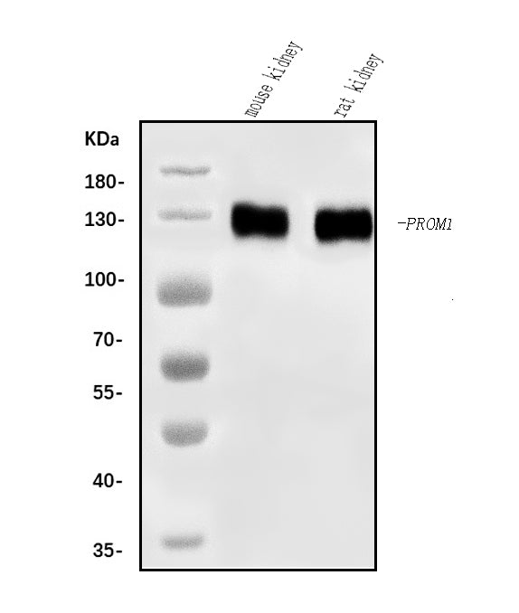 Anti-CD133/Prom1 Antibody Picoband®