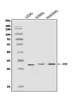 Anti-Superoxide Dismutase 3/EC-SOD/SOD3 Antibody Picoband®