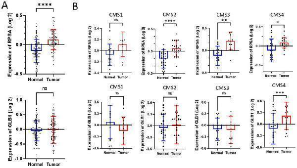 Anti-GLB1/Beta-galactosidase Antibody Picoband®